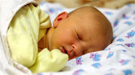 Imagen de un bebé con ictericia neonatal