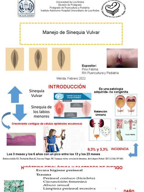 Esquema anatómico de la vulva normal y con sinequia vulvar parcial o completa en una lactante