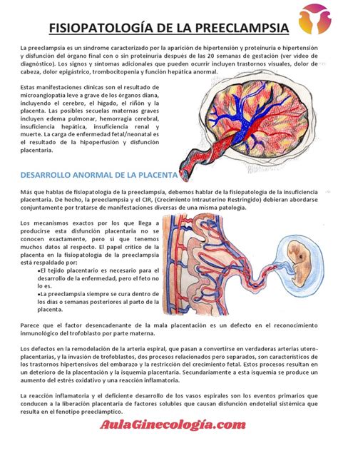 Infografía explicativa sobre la fisiopatología y los riesgos asociados a la preeclampsia en el embarazo.