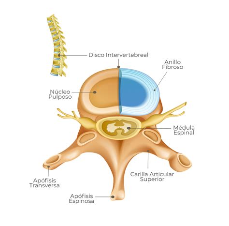 Esquema anatómico de la columna vertebral y el espacio subaracnoideo, destacando la localización de la médula espinal, las meninges (duramadre, aracnoides, piamadre) y el espacio subaracnoideo con el líquido cefalorraquídeo.