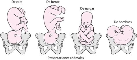 infografía explicando el descenso del bebé en la pelvis