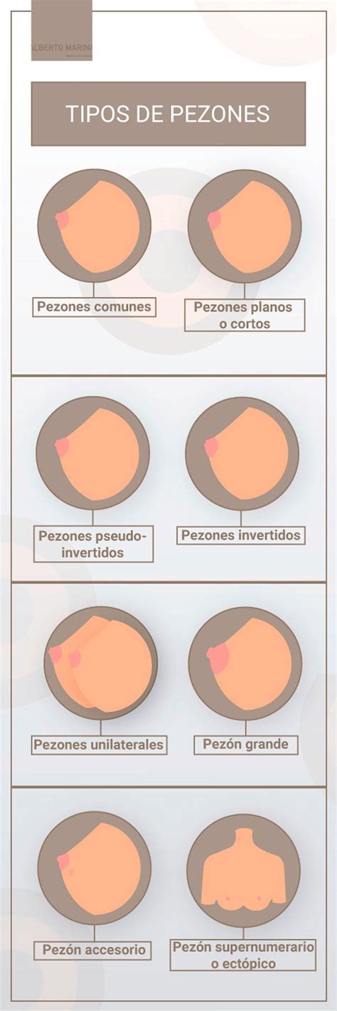 Ilustración comparativa de un pezón normal y un pezón con apariencia de piel de naranja.