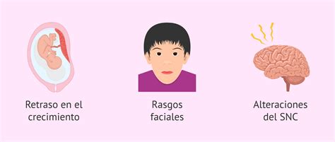 Infografía: Rasgos faciales y síntomas conductuales del Síndrome de Alcoholismo Fetal (SAF)
