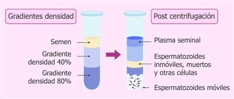 Esquema del proceso de separación de espermatozoides por gradientes de densidad