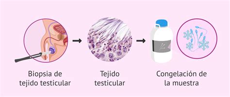 Ilustración científica del cultivo de tejido testicular para producir espermatozoides in vitro