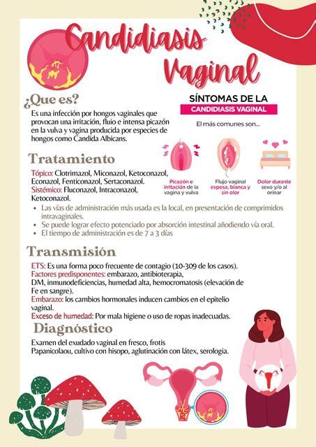 Esquema visual de la vagina mostrando síntomas de candidiasis