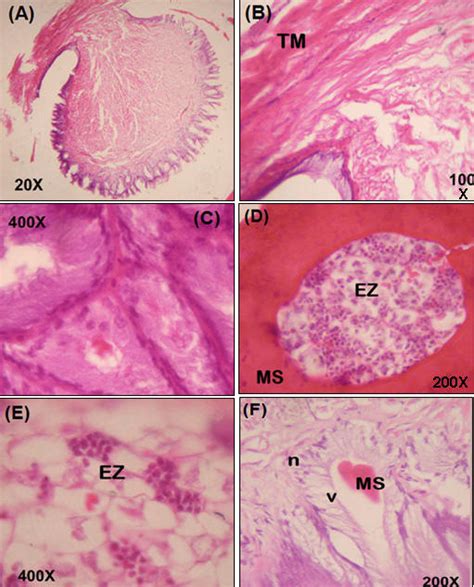 Estructura y imagen microscópica de los rodillos de grafeno de tres capas.