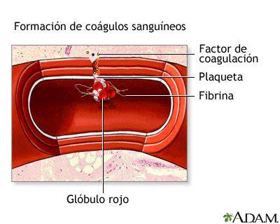 Infografía sobre la formación de coágulos sanguíneos