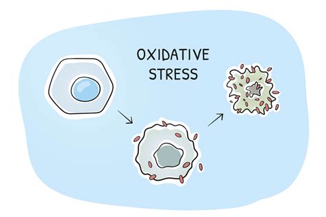 Infografía sobre las causas del estrés oxidativo y su impacto en la fertilidad masculina