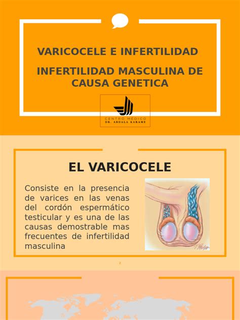 Esquema anatómico del varicocele pediátrico y su impacto
