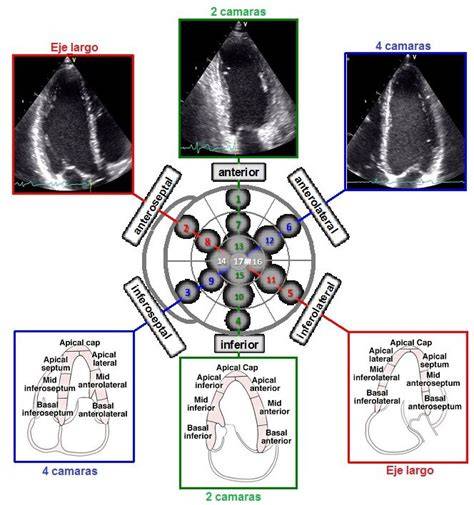Esquema de las estructuras cardíacas básicas en ecocardiografía pediátrica