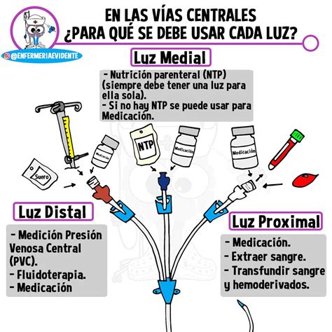 Ilustración 12: Representación de las luces de un catéter con indicación de la luz distal de mayor calibre.