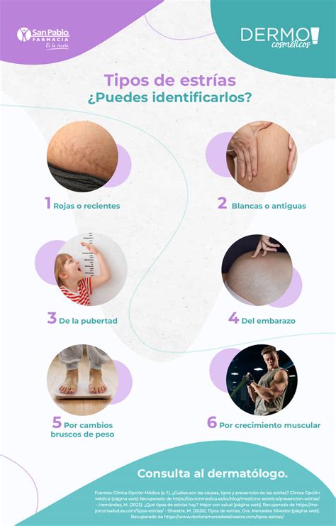 infografía sobre la formación de estrías en la piel