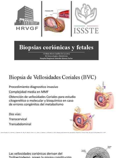 Infografía comparativa de la biopsia corial transcervical y transabdominal.