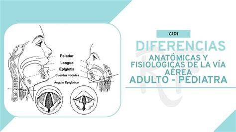 Esquema de las diferencias anatómicas de la vía aérea pediátrica versus adulta