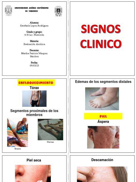 Diagrama de los signos clínicos para la verificación de la intubación endotraqueal