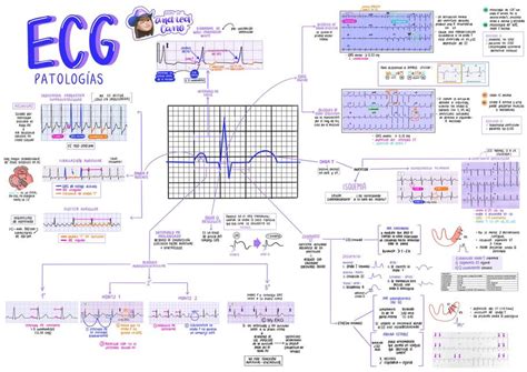 diagrama de las principales patologías detectadas por EEG neonatal