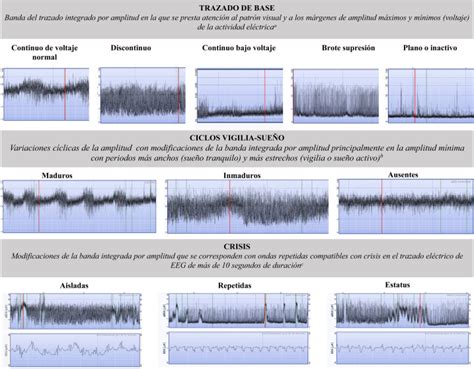 comparación de patrones de EEG en prematuros y recién nacidos a término