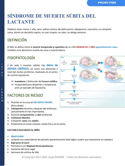 Esquema del modelo de riesgo triple para el Síndrome de Muerte Súbita del Lactante (SMSL)