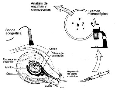 Muestra de vellosidades coriónicas para análisis genético