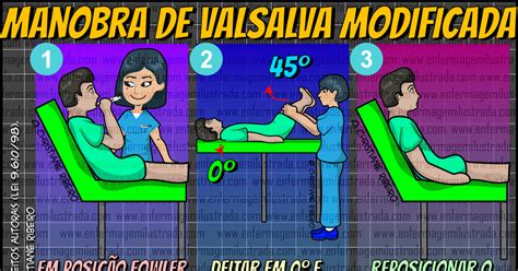 Ilustración de maniobras vagales aplicables en lactantes (ej. aplicación de hielo facial)