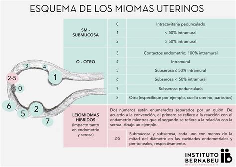 Diagrama de clasificación de miomas uterinos según FIGO