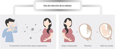 Imagen de una mujer embarazada enfatizando la protección contra la rubéola