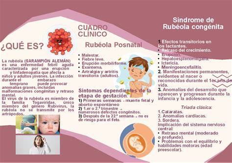 Infografía de la tríada de síntomas del Síndrome de Rubéola Congénita