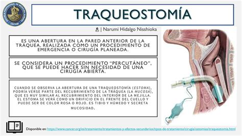 Gráfico de barras mostrando las principales indicaciones de traqueostomía en pacientes pediátricos según diferentes estudios