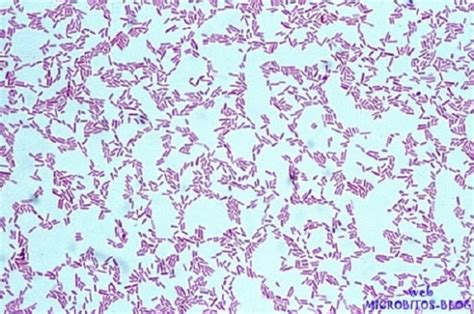 Microfotografía de Pseudomonas aeruginosa