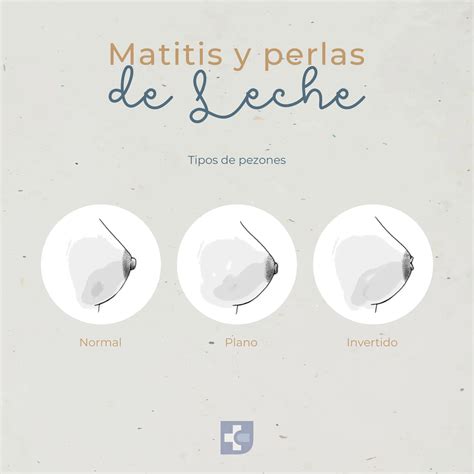 foto de pezones con ampollas por lactancia