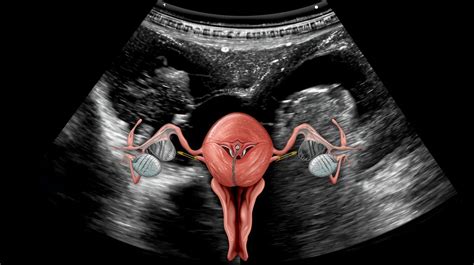 Imagen médica detallada de una ecografía ginecológica en 3D.