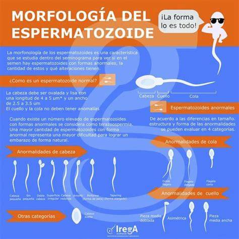Infografía sobre los espermatozoides y su estructura