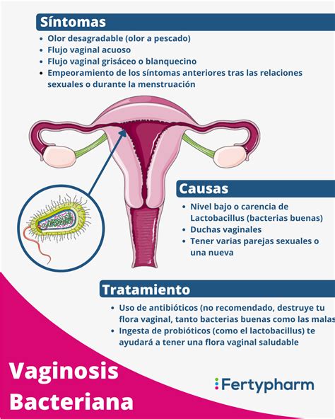 Esquema de la flora vaginal saludable versus flora con vaginosis bacteriana