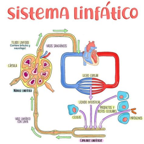 Esquema anatómico del sistema linfático mostrando la formación de quistes por obstrucción de vasos linfáticos