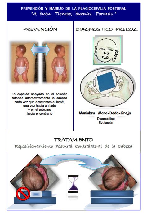 Infografía sobre la plagiocefalia en bebés: causas, prevención y uso de cojines antiplagiocefalia
