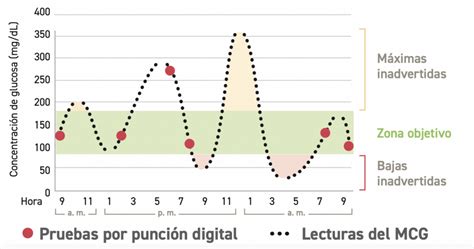 Gráfico de tendencias de glucosa de un sistema MCG con flechas indicadoras