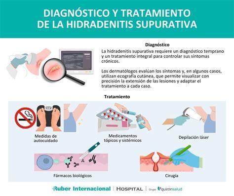 Diagrama de flujo que ilustra las opciones de tratamiento para la hidradenitis supurativa según la gravedad y respuesta del paciente.
