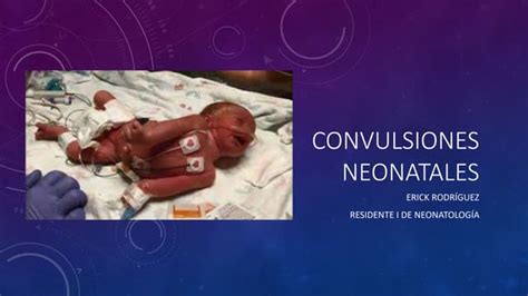 Gráfico comparativo de convulsiones y temblores benignos en neonatos