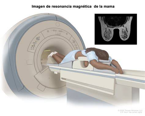 Imagen de resonancia magnética mostrando un desplazamiento o fractura del coxis