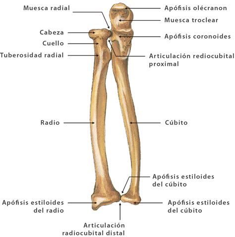 Esquema anatómico de la muñeca con el radio y cúbito, mostrando la ubicación típica de una fractura de Colles