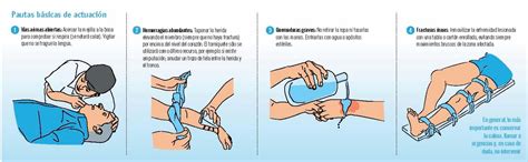 Foto de primeros auxilios para una fractura de muñeca con inmovilización y aplicación de hielo