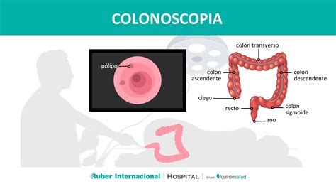 Imagen de colonoscopia mostrando la mucosa normal del colon.