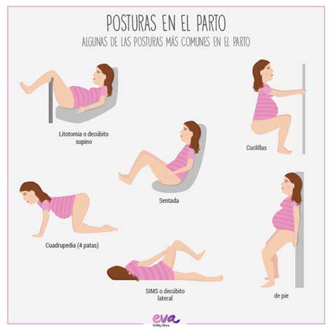 Ilustración mostrando diversas posiciones verticales para el parto: de pie, en cuclillas, arrodillada.