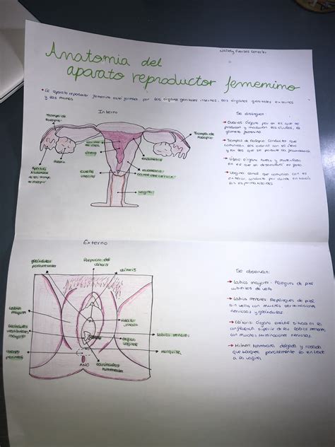 Ilustración anatómica del aparato reproductor femenino y localización de las patologías mencionadas