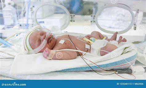 Bebé prematuro en incubadora conectado a monitores