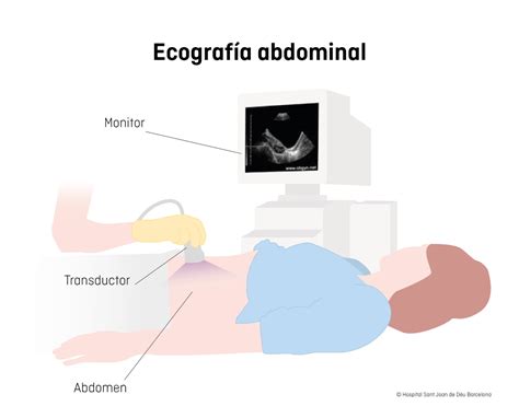 Esquema de funcionamiento de una ecografía obstétrica