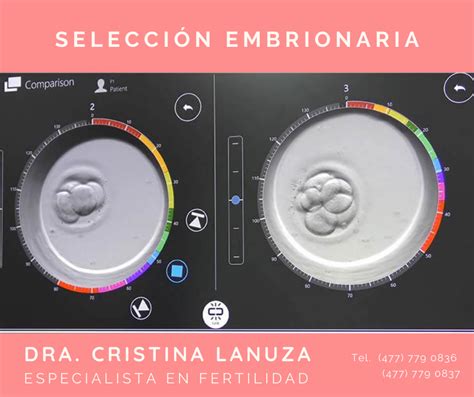 infografía sobre cómo la IA ayuda en la selección de embriones y la predicción de éxito