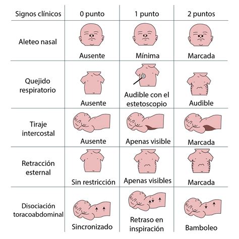 Ilustración de los posibles signos de distrés fetal
