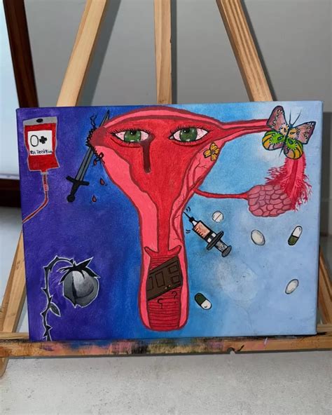 Imagen de un cuadro pintado por María Becerra, representando su experiencia con el embarazo ectópico.